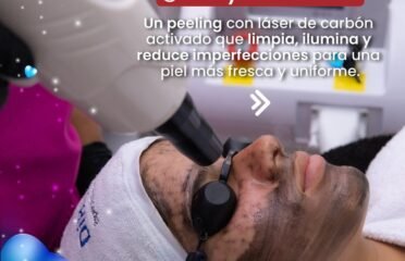 DiBye laser
